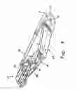 Fig. 06 - Birthing bed foot support release handle
