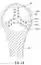 Fig. 11 - FLUID DRIVEN TOOTHBRUSH