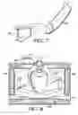 Fig. 05 - Surface cleaning apparatus