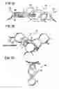 Fig. 03 - Clasp and method for assembling the same