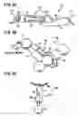 Fig. 07 - Clasp and method for assembling the same
