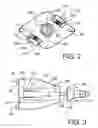 Fig. 03 - Decking Cone Device