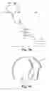 Fig. 06 - Weighted bioacoustic sensor and method of using same