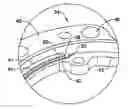 Fig. 01 - ISOLATION SYSTEM FOR AN INERTIAL MEASUREMENT UNIT