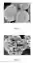 Fig. 02 - Platinum particles with varying morphology