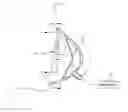 Fig. 01 - Arrangement and method for detecting spontaneous respiratory effort of a patient