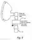 Fig. 08 - INJECTION CONTROL FOR NON-INVENTED MASK