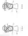 Fig. 05 - Device and method for shielding the urethra and bladder