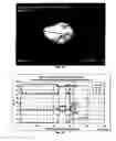 Fig. 02 - Method for treating powder particles