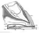 Fig. 01 - Inflatable horseshoe support pad