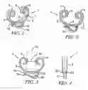Fig. 02 - Eaves clip