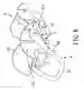 Fig. 09 - Child carrier