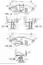 Fig. 08 - Methods of stitching interconnecting wires on a stator to reduce phase-on-phase conditions