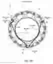 Fig. 14 - Methods of stitching interconnecting wires on a stator to reduce phase-on-phase conditions