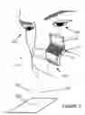 Fig. 03 - Ring device with optical focusing mechanism