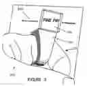 Fig. 04 - Ring device with optical focusing mechanism