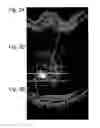 Fig. 04 - Method and system of coregistrating optical coherence tomography (OCT) with other clinical tests
