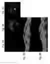 Fig. 07 - Method and system of coregistrating optical coherence tomography (OCT) with other clinical tests