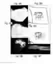 Fig. 10 - Method and system of coregistrating optical coherence tomography (OCT) with other clinical tests