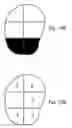 Fig. 11 - Method and system of coregistrating optical coherence tomography (OCT) with other clinical tests