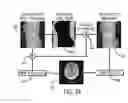 Fig. 08 - Method and system of CT data correction