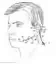 Fig. 01 - Earset microphone