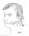 Fig. 02 - Earset microphone