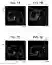 Fig. 08 - Method and apparatus for three-dimensional interactive tools for semi-automatic segmentation and editing of image objects