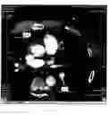 Fig. 07 - Automatic aortic detection and segmentation in three-dimensional image data