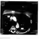 Fig. 08 - Automatic aortic detection and segmentation in three-dimensional image data