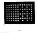 Fig. 06 - Image based correction for unwanted light signals in a specific region of interest