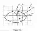 Fig. 10 - Two stage detection for photographic eye artifacts