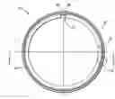 Fig. 01 - Snap ring design with anti-rotation structures at outer diameter