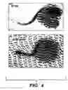 Fig. 07 - Methods and compositions for inhibiting cholesterol uptake