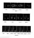 Fig. 07 - Optimized relaxivity and specificity hepatobiliary MRI contrast agent