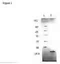 Fig. 02 - Recombinant protein comprising starch binding domain and use thereof