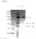 Fig. 07 - Recombinant protein comprising starch binding domain and use thereof