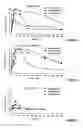 Fig. 06 - Derivatives of morphine-6-glucuronide, pharmaceutical compositions containing them, their preparation method and their uses