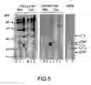 Fig. 06 - Lymphotoxin-beta, lymphotoxin-beta Complexes, pharmaceutical preparations and therapeutic uses thereof