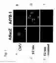 Fig. 02 - Use of the adenoviral E2 late promoter