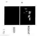 Fig. 03 - Use of the adenoviral E2 late promoter