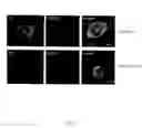 Fig. 02 - Method for activating T cell protein tyrosine phosphatase for therapeutic applications