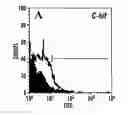 Fig. 01 - Methods of isolation, expansion and differentiation of fetal stem cells from chorionic villus, amniotic fluid, and placenta and therapeutic uses thereof