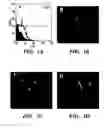 Fig. 02 - Methods of isolation, expansion and differentiation of fetal stem cells from chorionic villus, amniotic fluid, and placenta and therapeutic uses thereof
