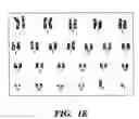 Fig. 03 - Methods of isolation, expansion and differentiation of fetal stem cells from chorionic villus, amniotic fluid, and placenta and therapeutic uses thereof
