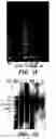 Fig. 04 - Methods of isolation, expansion and differentiation of fetal stem cells from chorionic villus, amniotic fluid, and placenta and therapeutic uses thereof