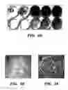 Fig. 06 - Methods of isolation, expansion and differentiation of fetal stem cells from chorionic villus, amniotic fluid, and placenta and therapeutic uses thereof