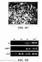Fig. 10 - Methods of isolation, expansion and differentiation of fetal stem cells from chorionic villus, amniotic fluid, and placenta and therapeutic uses thereof