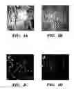 Fig. 11 - Methods of isolation, expansion and differentiation of fetal stem cells from chorionic villus, amniotic fluid, and placenta and therapeutic uses thereof