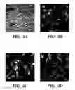 Fig. 13 - Methods of isolation, expansion and differentiation of fetal stem cells from chorionic villus, amniotic fluid, and placenta and therapeutic uses thereof